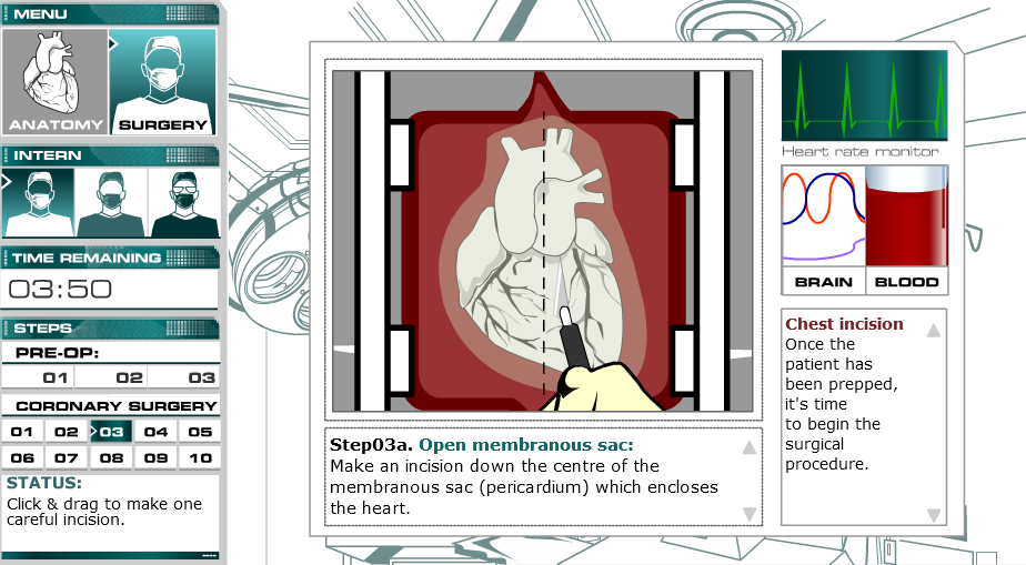 Open Heart Surgery Gameplay